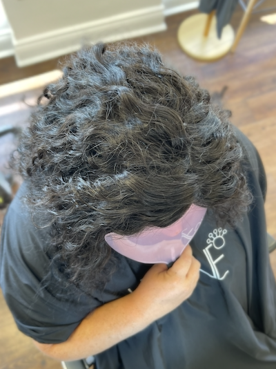 Hairloss Solutions Oxford County