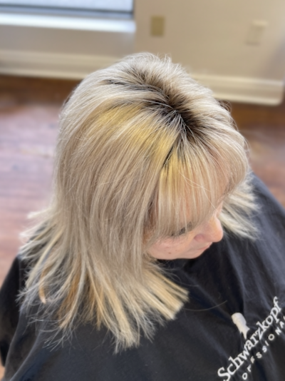 Hair Loss Solutions Woodstock